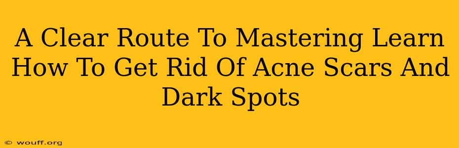 A Clear Route To Mastering Learn How To Get Rid Of Acne Scars And Dark Spots