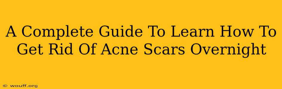 A Complete Guide To Learn How To Get Rid Of Acne Scars Overnight