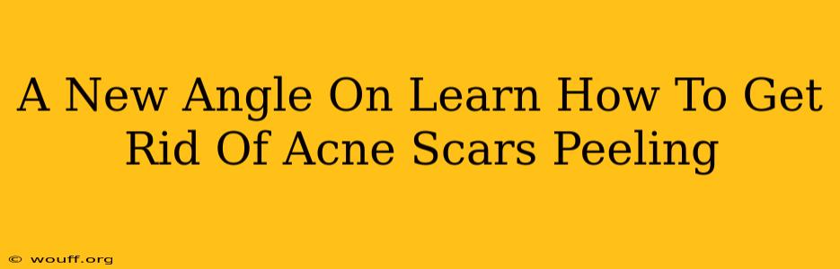 A New Angle On Learn How To Get Rid Of Acne Scars Peeling