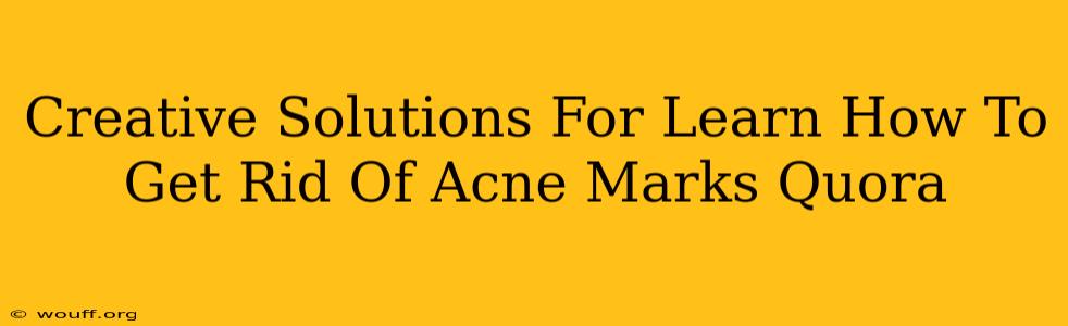 Creative Solutions For Learn How To Get Rid Of Acne Marks Quora