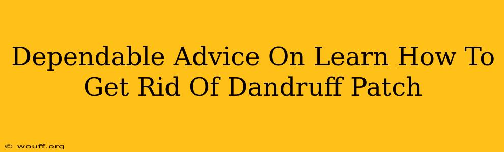 Dependable Advice On Learn How To Get Rid Of Dandruff Patch