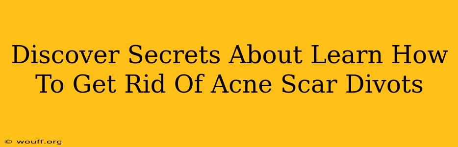 Discover Secrets About Learn How To Get Rid Of Acne Scar Divots