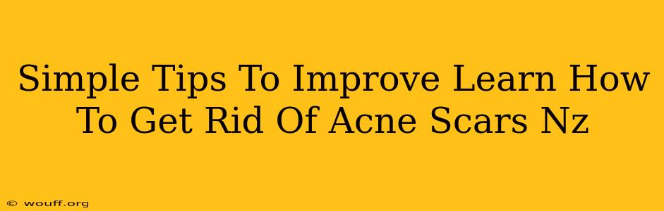 Simple Tips To Improve Learn How To Get Rid Of Acne Scars Nz