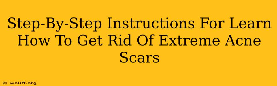 Step-By-Step Instructions For Learn How To Get Rid Of Extreme Acne Scars